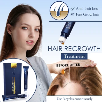 עוצמה לצמיחה מחודשת שיער סרום נגד נשירת שיער לקדם נוזל לתקן ולהזין את שורשי השיער לצמיחה מחודשת שולט Hairfall טיפוח השיער