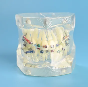 שיניים טיפול אוראלי שן שיניים המודל שיניים אורתודונטי מודל עבור המטופל תקשורת שיניים מחקר מודל